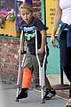 reese witherspoon deacon crutches 10