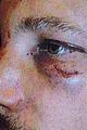 gabriel aubry black eye bloody face revealed 06