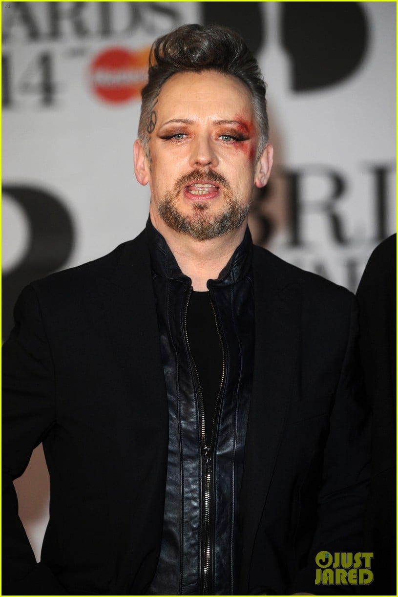 boy george attends brit awards with bruised bloodied eye 073056388