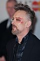 boy george attends brit awards with bruised bloodied eye 03