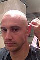 james franco is bald shaves his head 01