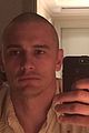 james franco is bald shaves his head 02