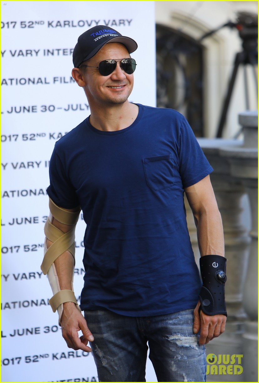 jeremy renner reveals how he injured both his arms 083924719