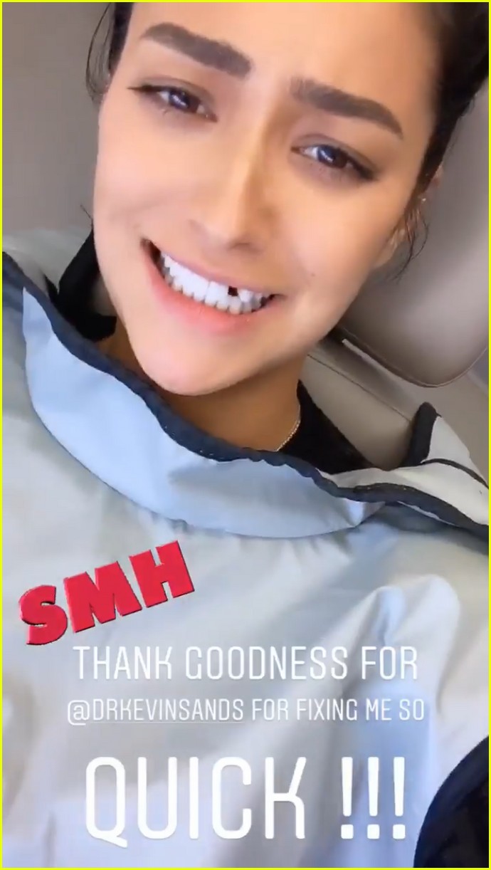 shay mitchell missing tooth 044274811