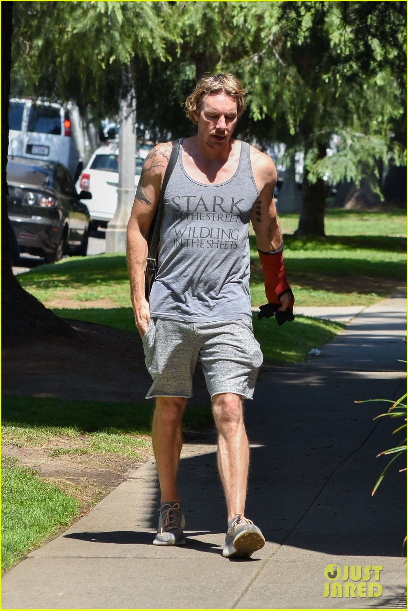 dax shepard steps out wearing a cast 214456245