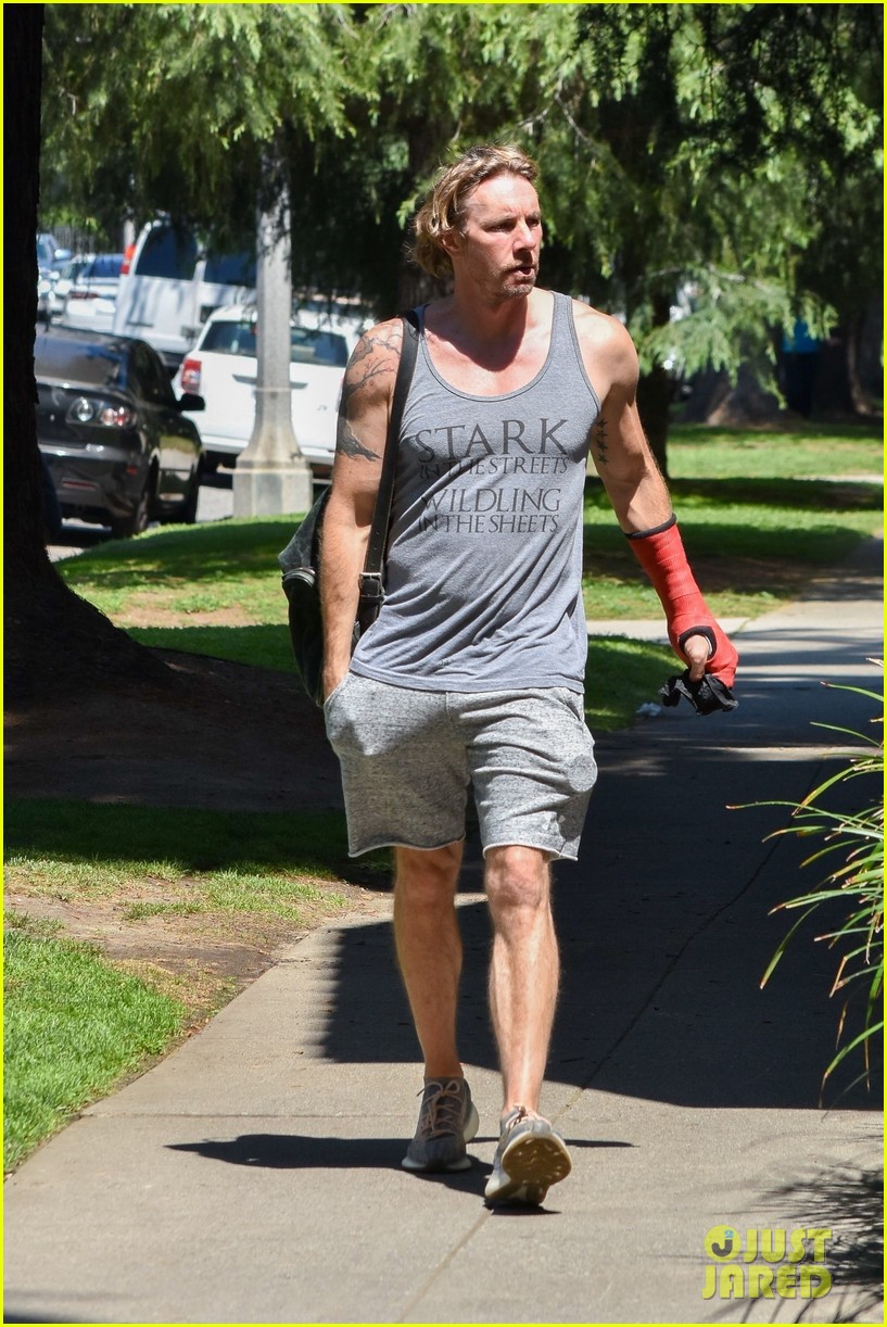 Dax Shepard Steps Out in a Cast After Performing Surgery on Himself