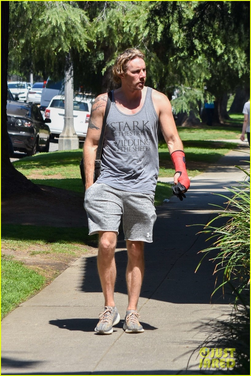 Dax Shepard Steps Out in a Cast After Performing Surgery on Himself