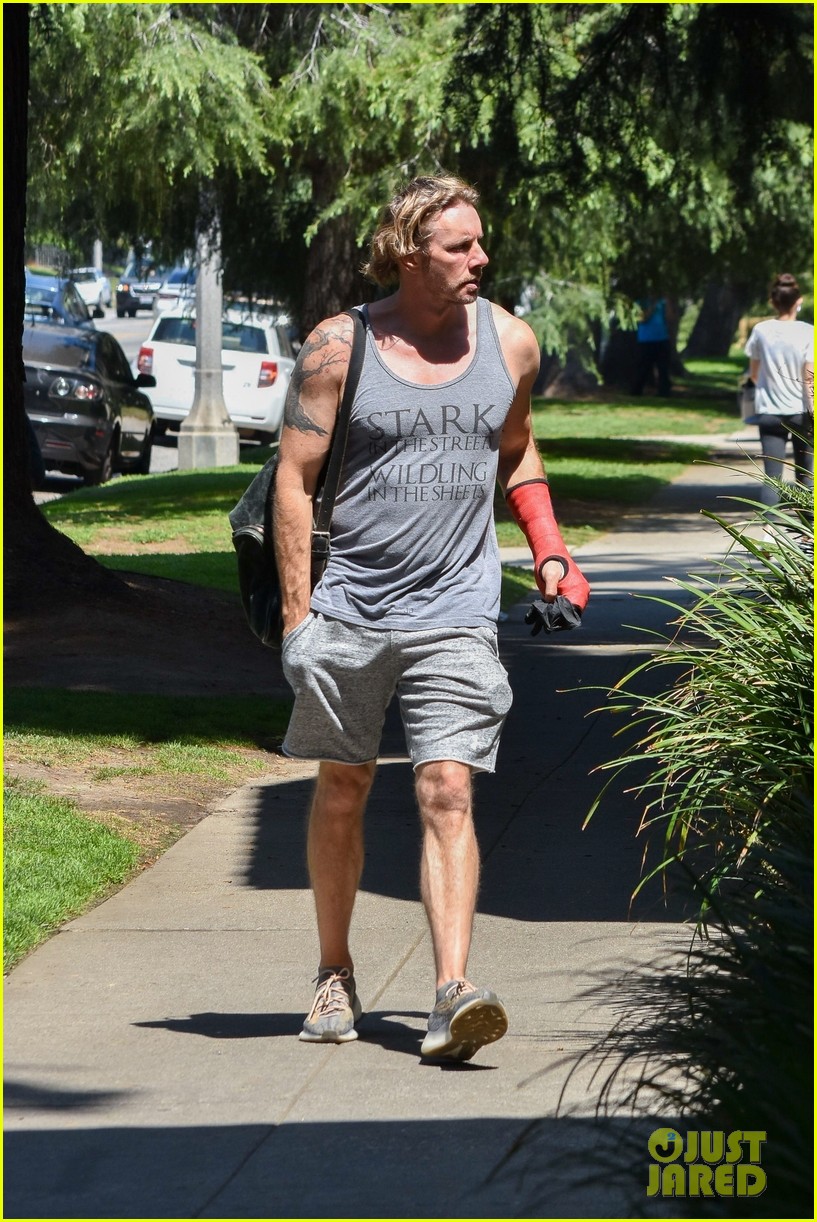 dax shepard steps out wearing a cast 274456251