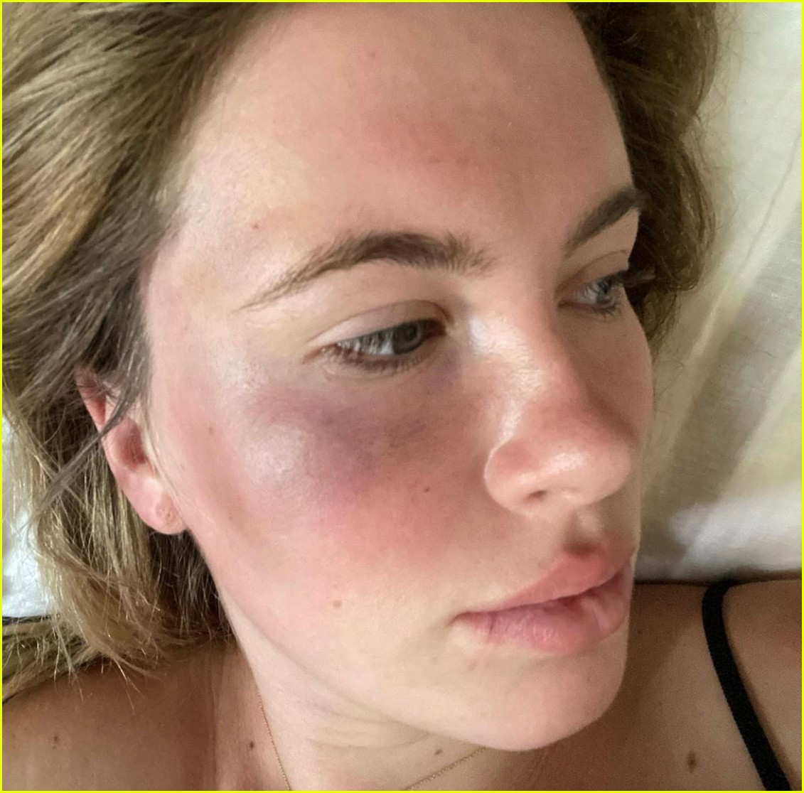 ireland baldwin attacked and robbed 024477171