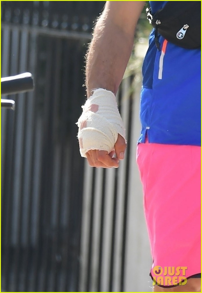 dominic cooper bandages on his hand outing 034479854