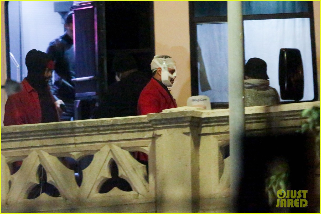 the weeknd head covered with bandages filming new video 21