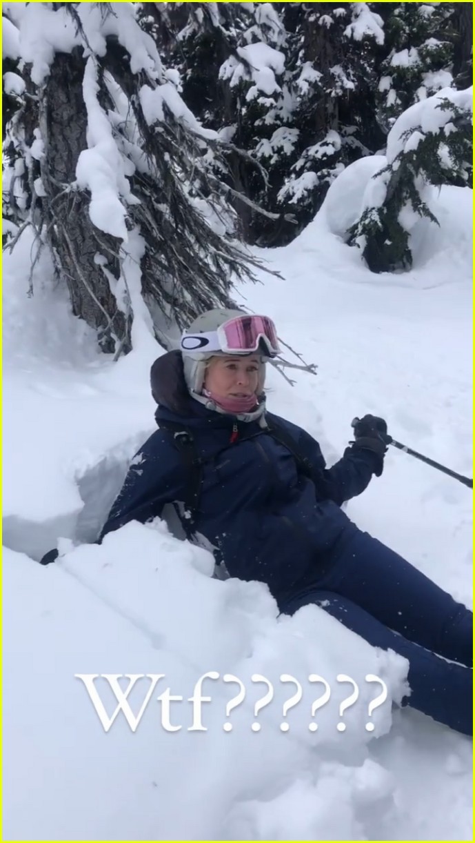 chelsea handler ski injury 02