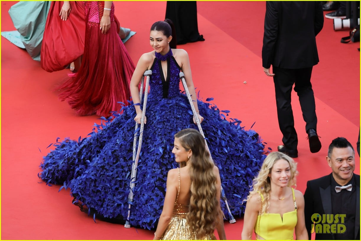Cambodian Actress Yubin Shin Walks With Crutches On Cannes Film