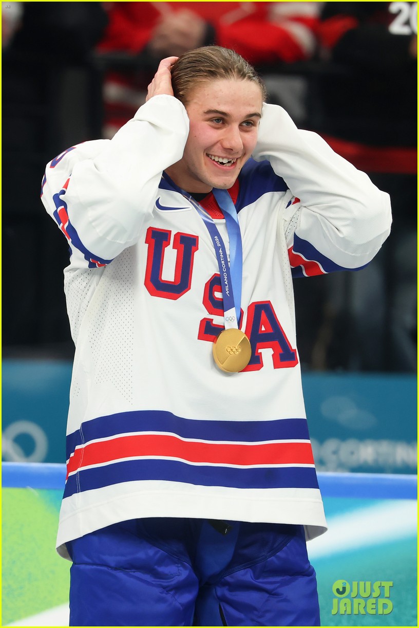 jack hughes teeth olympics 2026 win 015284548