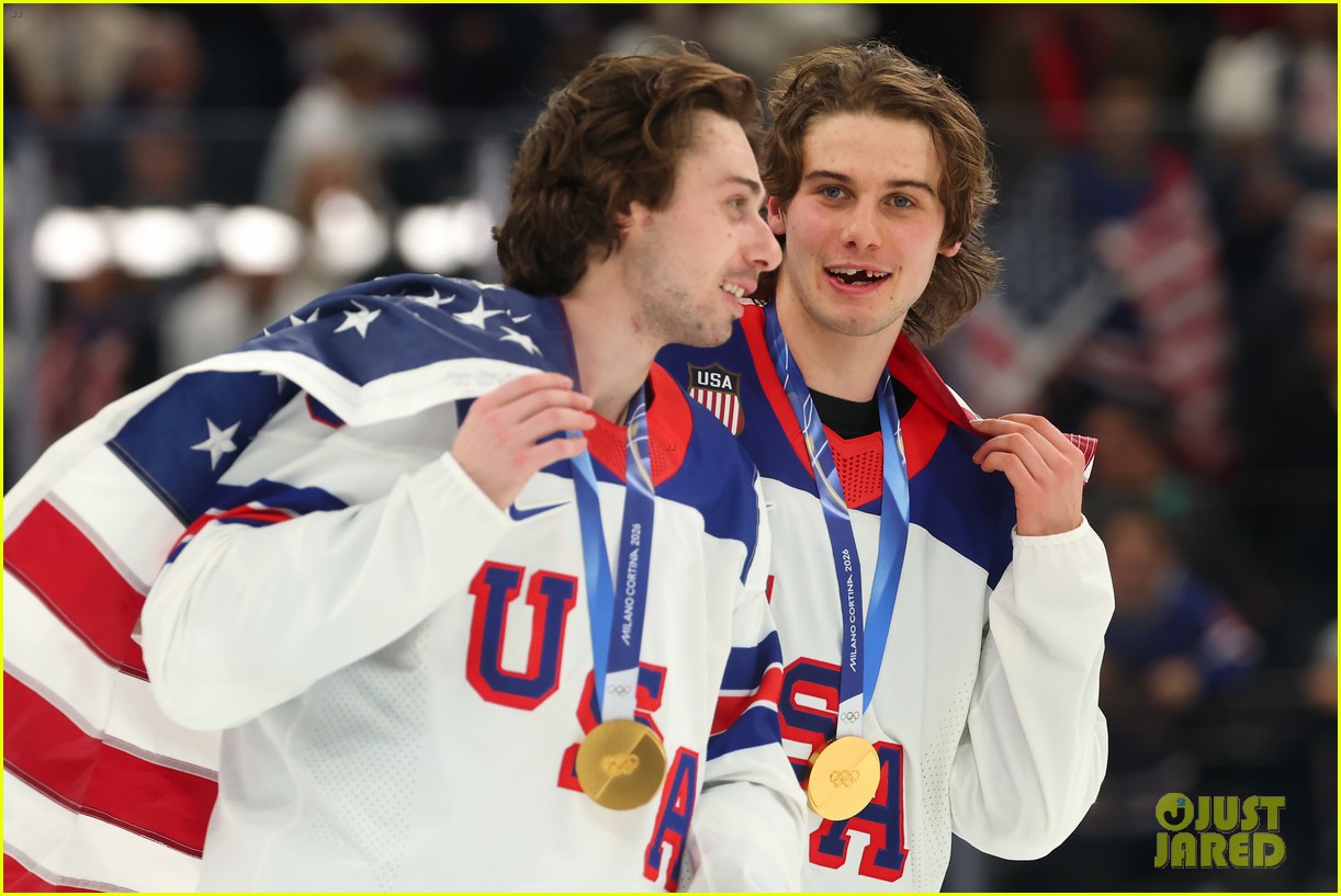 jack hughes teeth olympics 2026 win 045284551