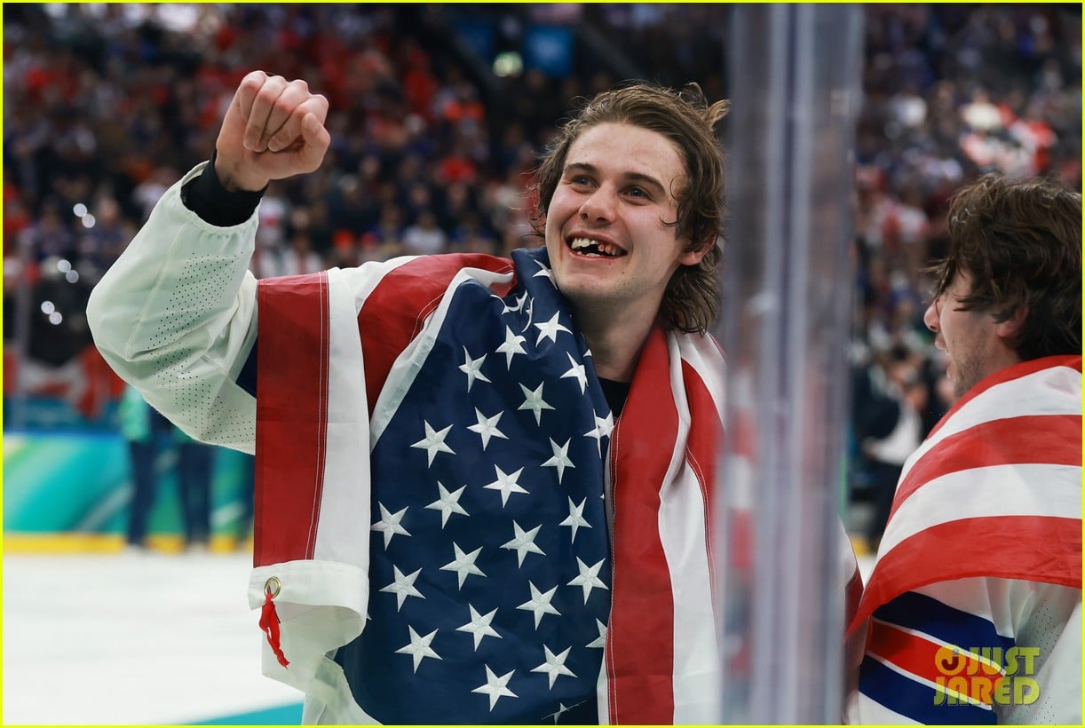 jack hughes teeth olympics 2026 win 085284555