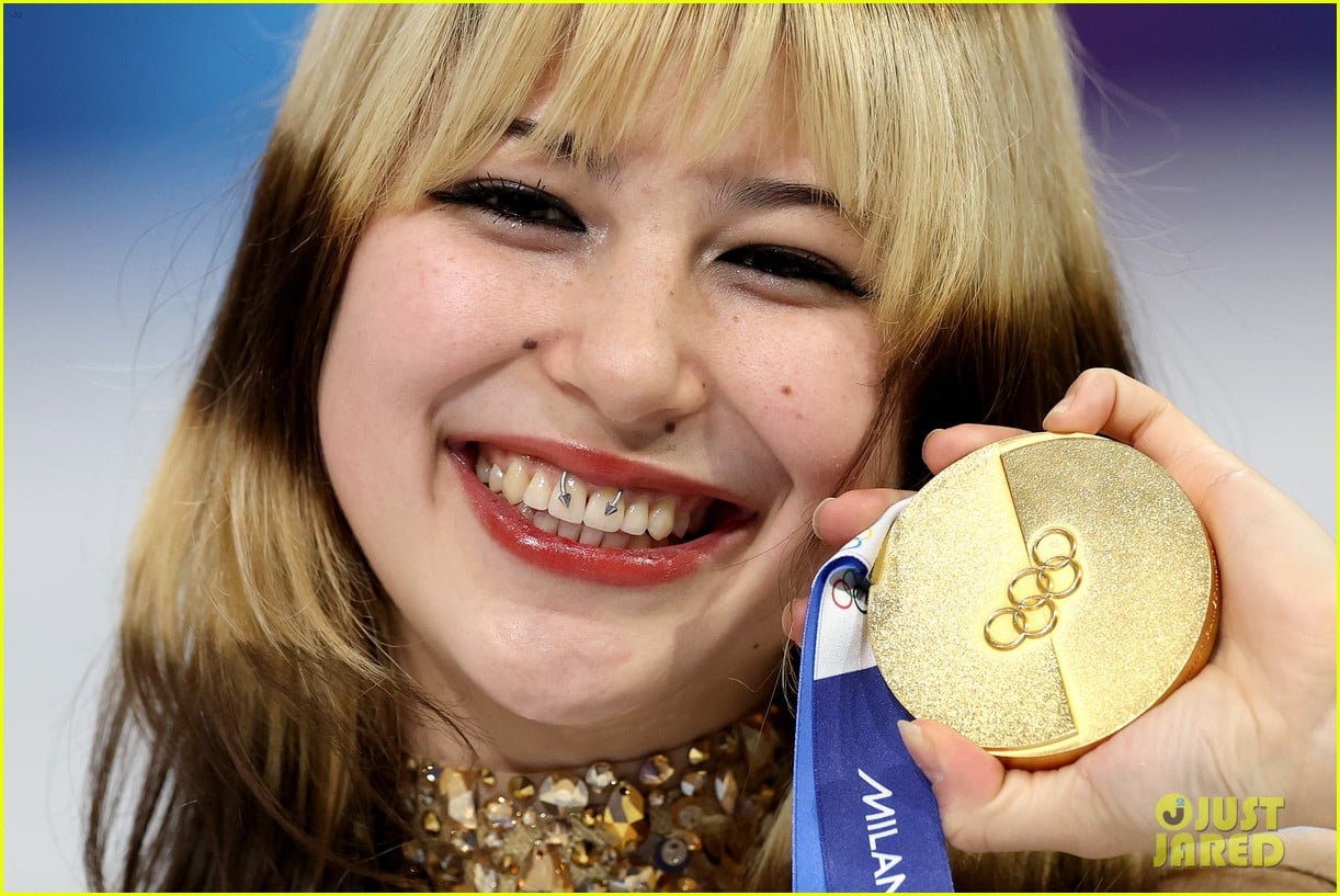 whats on alysa liu teeth 015283402