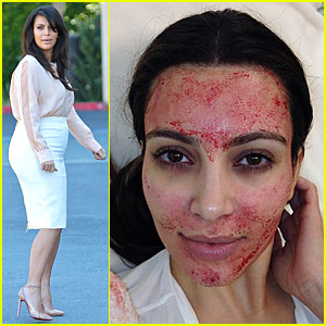 Pregnant Kim Kardashian's Vampire Facial!