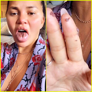 Chrissy Teigen Says Her 'Tongue Is Falling Off' from Eating 'So Much' Sour Candy