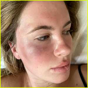 Ireland Baldwin Was Attacked & Robbed by Woman Who Was 'High Out of Her Mind'