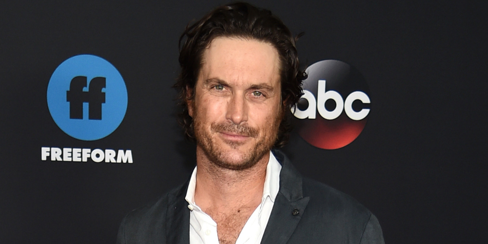 Oliver Hudson Says He Looked Like This After His First Round of Botox(00)