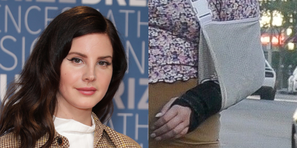 Lana Del Rey Reveals How She Fractured Her Arm Lana Del Rey