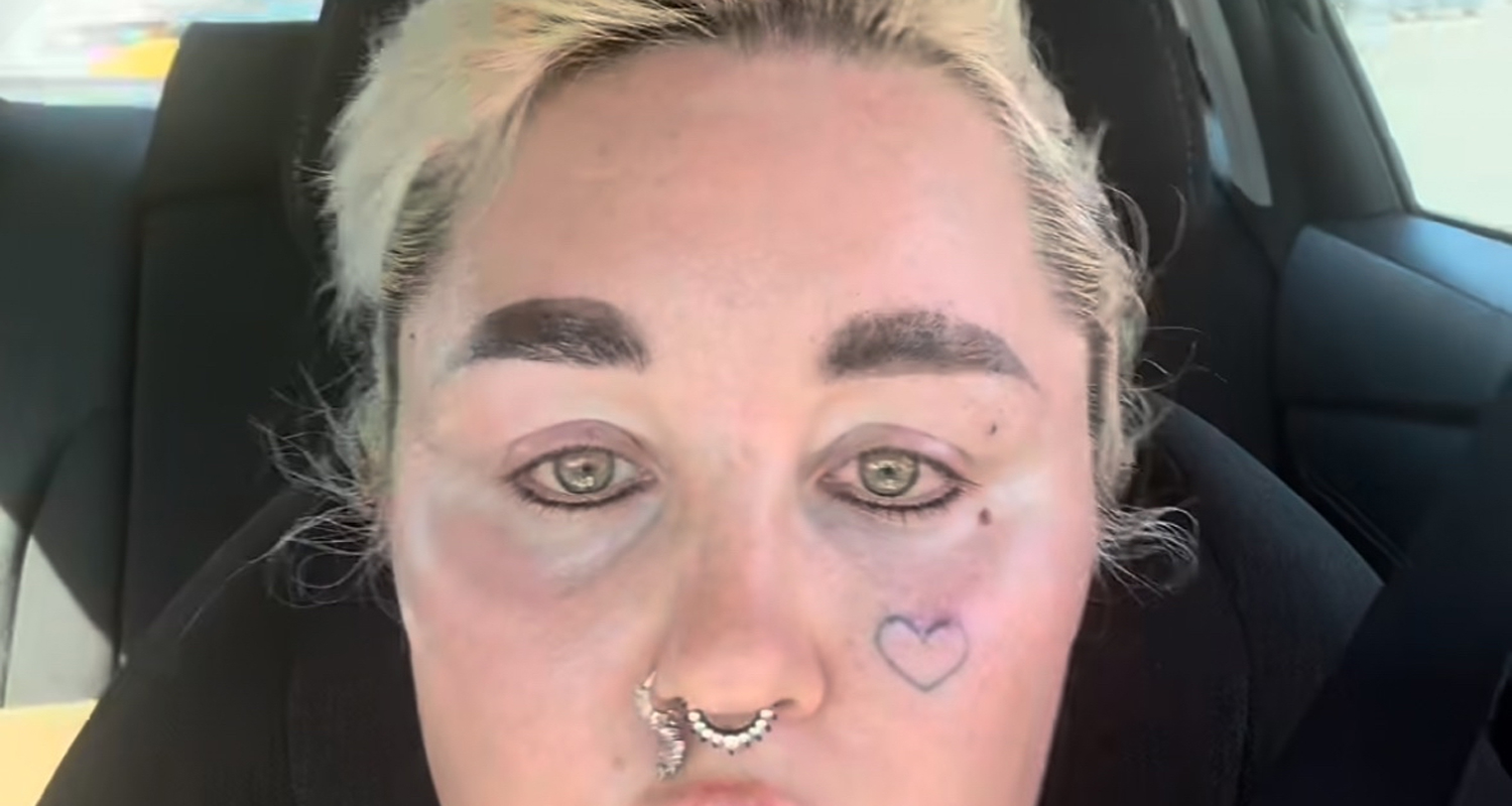 Amanda Bynes Shows Off Lip Injections In New Video | Amanda Bynes | Just Jared: Celebrity News and Gossip