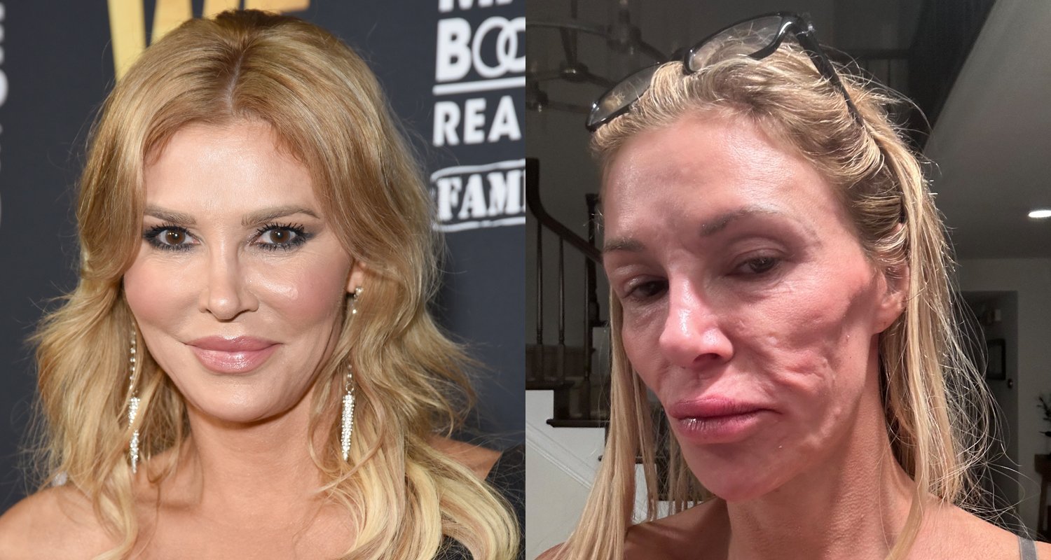 Brandi Glanville dice que “finalmente fue diagnosticada después de luchar contra el ‘parásito'” | Brandi Glanville | Noticias y chismes | Entretenimiento, fotos y vídeos