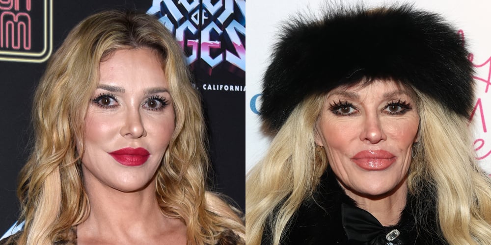 Brandi Glanville elogia al cirujano plástico por su nueva apariencia un mes después del diagnóstico de desfiguración facial | Brandi Glanville | Noticias y rumores de celebridades | Entretenimiento, fotos y vídeos