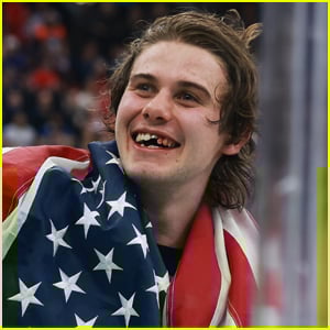 NHL Star Jack Hughes Gets Teeth Knocked Out During Olympics 2026 Hockey Win, Celebrates the Victory with Bloody Mouth Photos