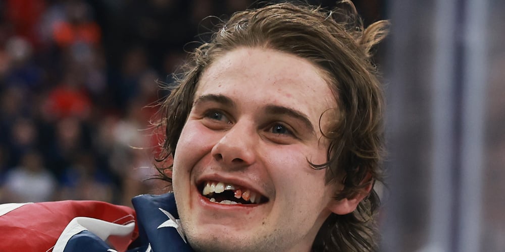 A estrela da NHL, Jack Hughes, vence o hóquei durante as Olimpíadas de 2026 e comemora a vitória com fotos ensanguentadas na boca | Olimpíadas 2026, Jack Hughes, Olimpíadas | Notícias e fofocas sobre celebridades Entretenimento, fotos e vídeos