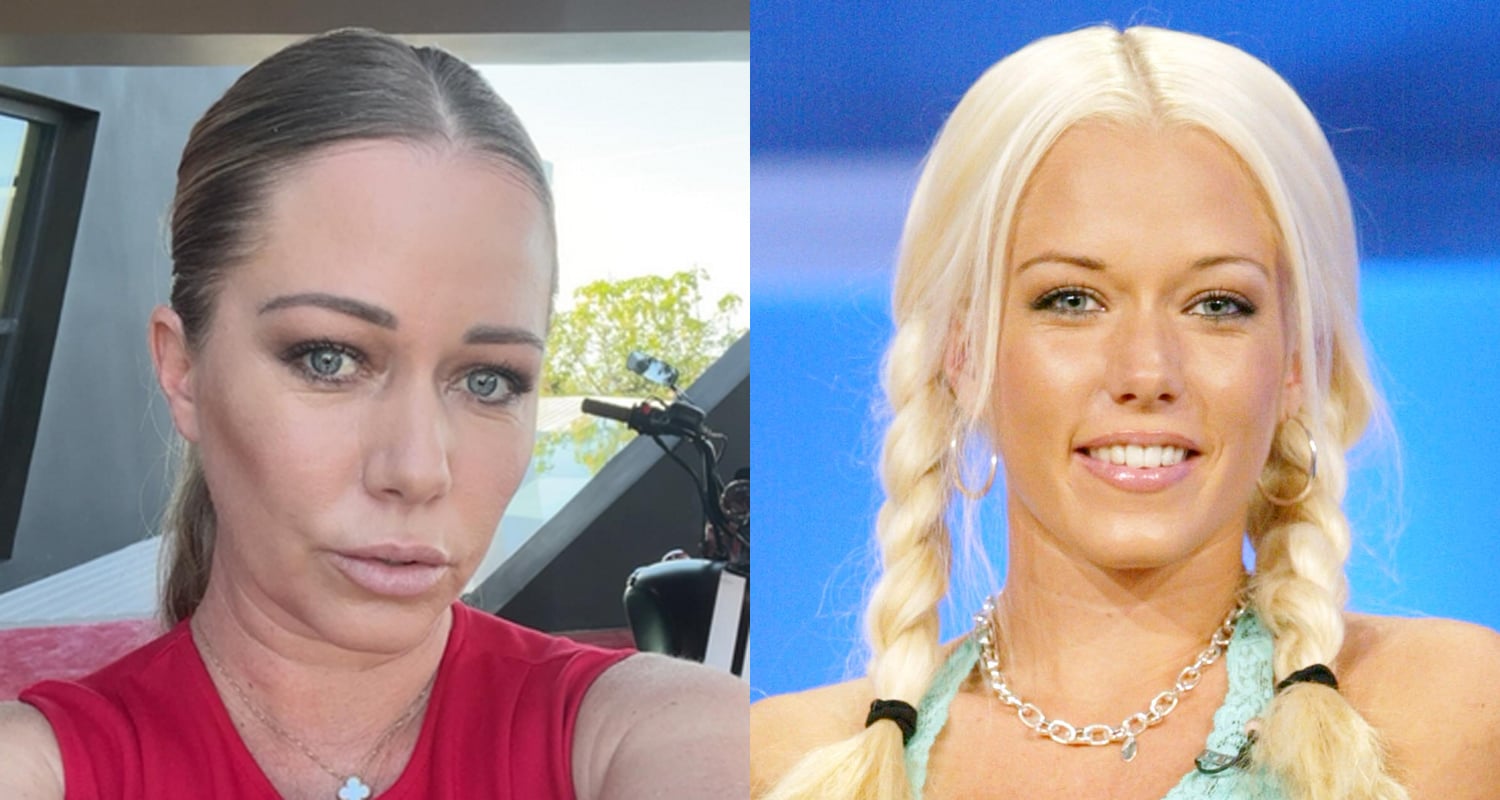 Kendra Wilkinson revida trolls que dizem que ela é ‘feia’ | Kendra Wilkinson | Notícias e fofocas sobre celebridades Entretenimento, fotos e vídeos