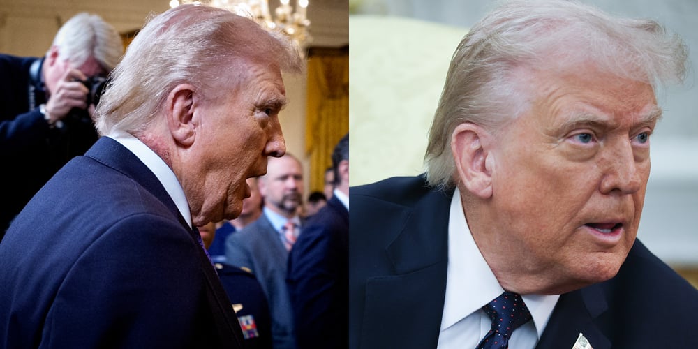 Trump parece estar cobrindo as misteriosas cicatrizes no pescoço com maquiagem (foto) | Donald Trump, Saúde, Política | Notícias e fofocas sobre celebridades Entretenimento, fotos e vídeos