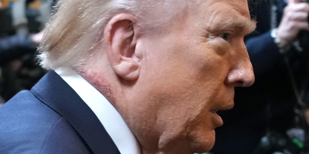 Nas novas fotos, há sinal neutro no pescoço de Donald Trump Donald Trump Notícias e fofocas de celebridades Entretenimento, Fotos e Vídeos