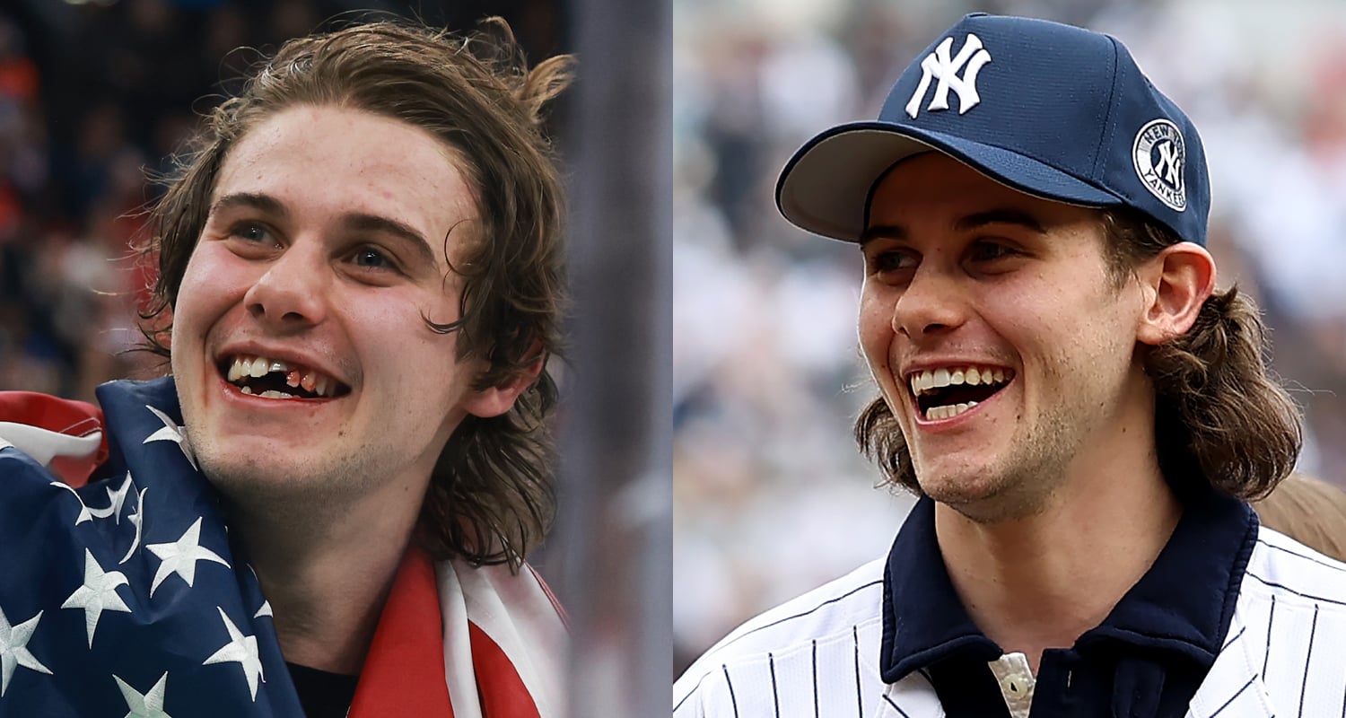 Jack Hughes Shows Off New Teeth as He Throws First Pitch at Yankees Opening Day Game